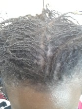 New sisterlocks and dry scalp